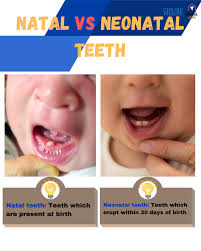 Image result for Neonatal Teeth