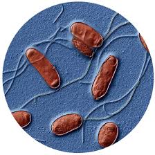 It's caused by the bacterium legionella pneumophila found in both potable and nonpotable water more hospitals are facing the dilemma of legionella outbreaks as they discover the drinking water is. Legionella And Legionnaire S Disease Norsesense No