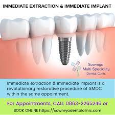 Check spelling or type a new query. Pin By Dr Khush On Dental File In 2021 Tooth Extraction Healing Tooth Extraction Care Dentist Near Me