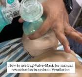 Using a Bag Valve Mask 🫁⁠ ⁠ Continuous breaths = Rescue ...