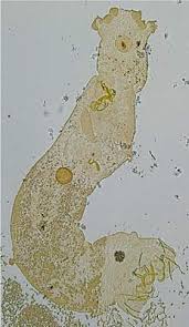 Image result for Cyclocotyla