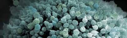 We did not find results for: Aspergilloses Definition Symptomes Et Traitements
