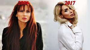 Check spelling or type a new query. Svetlana Loboda V Molodosti I Posle Plastiki Foto Pevicy