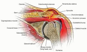Image result for Biceps Tendon Injection