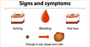 People should check for symptoms of melanoma and other skin cancers every month. Skin Cancer Early Signs Symptoms