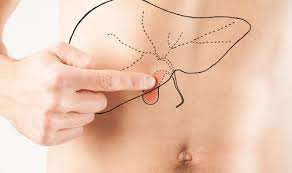 Gallensteine Symptome Behandlung Netdoktor At