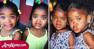 Check spelling or type a new query. Ces Filles Ont Ete Surnommees Les Plus Belles Jumelles Au Monde Voila A Quoi Elles Ressemblent Aujourd Hui