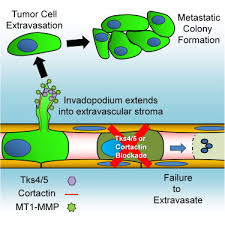 Metastatic cancer is a late stage development of a disease process that often developed silently for many years. Invadopodia Are Required For Cancer Cell Extravasation And Are A Therapeutic Target For Metastasis Sciencedirect