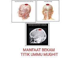 Maybe you would like to learn more about one of these? Kelebihan Bekam Kepala My Rehab Spa