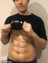 El hijo del chino maidana tiene un canal de youtube donde aparece con el chino comentando sus peleas, terrible cago de risa. Man From Thailand Undergoes Bizarre Liposuction Procedure To Get Six Pack Abs Daily Mail Online