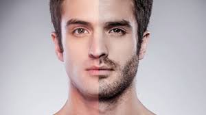 The type of hypertrichosis specific to women is. How To Grow A Beard Faster Naturally Grooming Tips Alex Costa Youtube