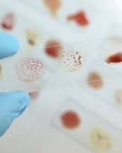 Grupa sanguină 0 (01) este cea mai întâlnită grupă de asemenea, persoanele cu această grupă de sânge sunt vulnerabile la inflamaţii şi reacţii cea mai buna grupa de sange cea mai buna grupa sanguina grupa 0 grupa a grupa ab grupa b grupa de. Grupa De Sange Ab Cui PoÅ£i Dona Si La Ce Boli Esti PredispusÄƒ Divahair Ro