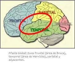 Maybe you would like to learn more about one of these? Neuroclass On Twitter Afasia Global Lesion En La Zona Frontal Temporal Y Parietal La Comprension Y La Expresion Se Encuentran Alteradas Https T Co Bdpf5dabp8