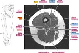 We look at the associated symptoms and treatment options. Mri Of The Thigh Radiology Key