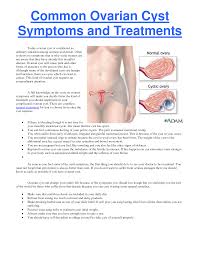 Gastritis Remedies All Natural Remedies Signs Symptoms As Well As How To Conquer Normally As Well Ovarian Cyst Symptoms Endometriosis Symptoms Ovarian Cyst