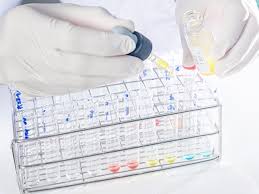 Submitted 20 hours ago by feartakesprisoners. Guidance To Sponsors On How To Manage Clinical Trials During The Covid 19 Pandemic European Medicines Agency