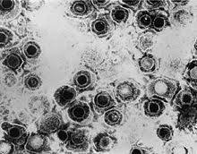 Virus Dell Herpes Simplex Wikipedia