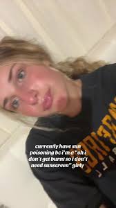 my nose piercing is so swollen help #relatable #sunburnt #fypage