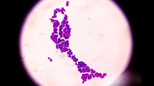 Image result for Buchnera candida