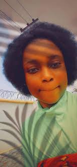 This lady is a social media influencer, her real name is Eldiara Doucette,  but she's known by her fans as Bionic Barbie. She recently l0zt her arm to  c@nc€r but what she