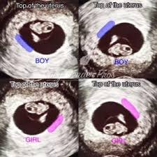 Pin On Baby Gender Predictions