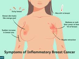 Bumps on or under the skin of the chest wall. Breast Cancer Organisation India Turns Pink Breast Caner Awareness Breast Cancer Organisation Breast Cancer Awareness Foundation Breast Cancer Ngo Breast Cancer Awareness In India Breast Cancer Awareness In Chennai