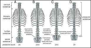 The human back, also called the dorsum, is the large posterior area of the human body, rising from the top of the buttocks to the back of the neck. Schematic View Of Vertebral Columns Illustrating Different Presacral Download Scientific Diagram