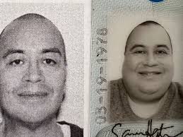 Fundraiser by Sam Heaton : Excess Skin Removal Surgery