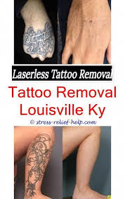 Does insurance cover tattoo removal? Tattoo Removal Procedure Best Tattoo Removal Doctors Rejuvi Tattoo Removal Cream Tattoo Removal Londo Tattoo Removal Tattoo Removal Cost Laser Tattoo Removal