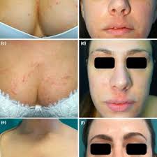 Alessandra CHIEI GALLO