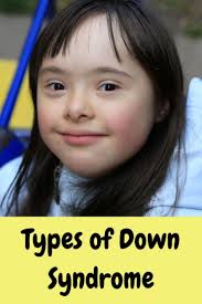 Types of Down Syndrome