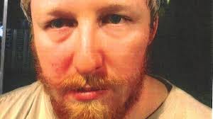 Jarryd Primmer: man jailed for glassing victim at St James nightclub