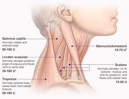Cervical Dystonia And Fibromyalgia What Is The Difference Us Health Magazine Anatomia Fisiologia Fibromialgia