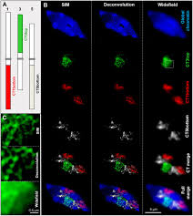 We did not find results for: Frontiers Super Resolution Microscopy Applications In Plant Cell Research Plant Science