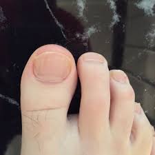 Image result for big toe