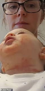 Baby's eczema disappeared within hours of using £10.95 cream