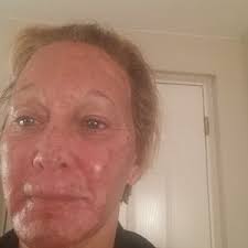 Roy A. David, MD, Board Certified Facial Plastic Surgeon