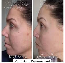 Stacey Shields Skincare