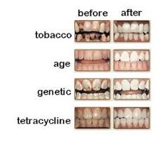 Anything Anyone Ayurvedic Practice Oil Pulling Oil Pulling Coconut Oil For Teeth Coconut Oil Pulling