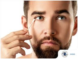 Image result for Eye Discharge