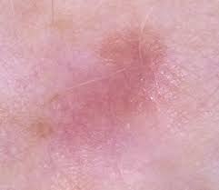 Pin On Health