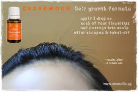 It's great for the treatment of hair loss and for dandruff control. One Oil At A Time Cedarwood The Brain And Hair Food Mumzillaveron