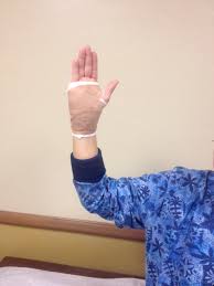 Repetitive activities and overuse are often responsible for de if these treatments do not provide relief, surgery may be recommended. Helpful Tips For Post Operative Elbow Hand And Shoulder Surgery Tucson Orthopaedic Institute