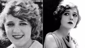 This is probably the most tragic case of plastic surgery in old Hollywood.  Mary was a star of silent movies in the 1920s, and everything was going  well for her. However she