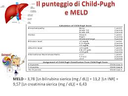 Image result for MELD Score