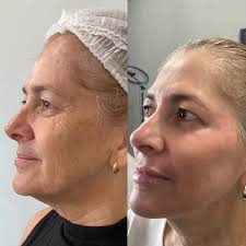 Dr Marco Antonio (@dr_marcoantonio) • Instagram फोटोहरू र भिडियोहरू