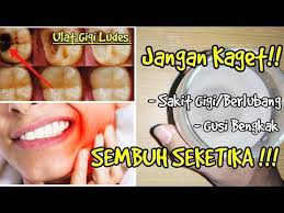 Doa untuk sakit gigi dan gusi bengkak. Cara Mengobati Sakit Gigi Tak Berlubang Bisabo