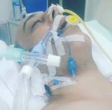 Kondisi kesehatan syekh ali jaber sempat dilaporkan membaik pada 4 januari 2021. Syekh Ali Jaber Meninggal Sudah Negatif Corona Kesehatan Beritamerdeka Net