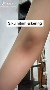 Pin By Widhi Salisa On Armpits Video In 2020 Recommended Skin Care Products Skin Routine Candy Hair
