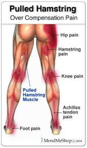 A tendon is essentially a fibrous band of tissue that connects muscle. Pin On Health